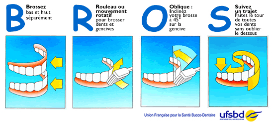 Schéma brossage de dents